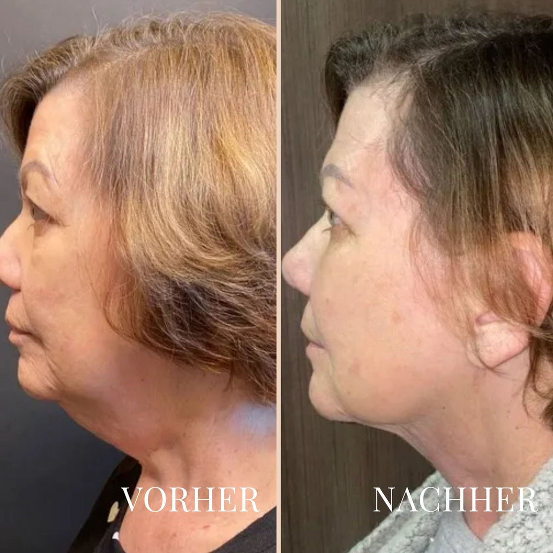 LinaLift Hals- und Augenpflege Creme