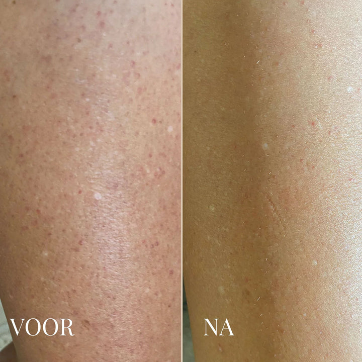 DR. MELAXIN KÖRPERPEELING SPRAY