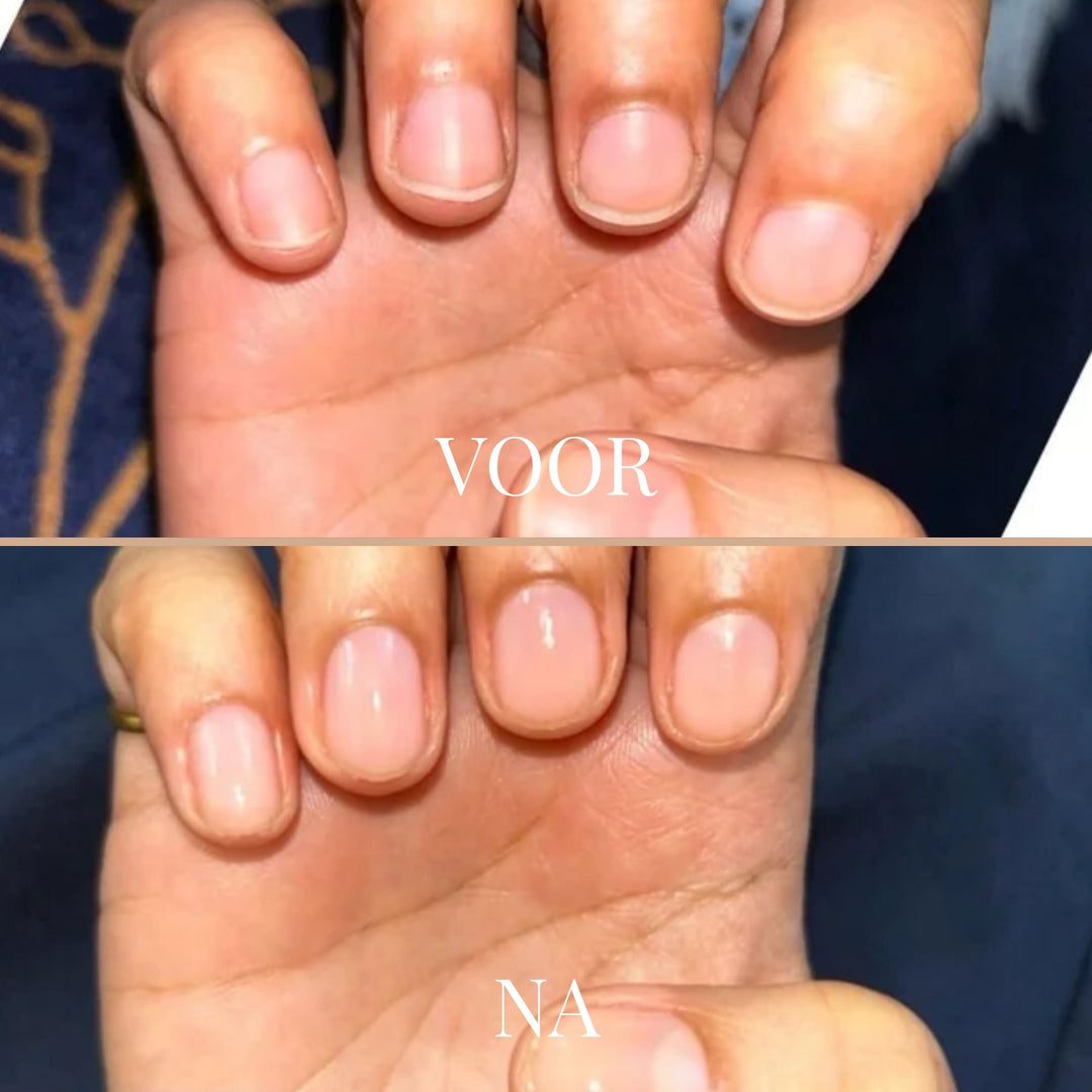 GentleGrip Elektrischer Nagelschneider