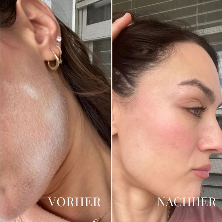 PeachAway Gesichtshaarentferner