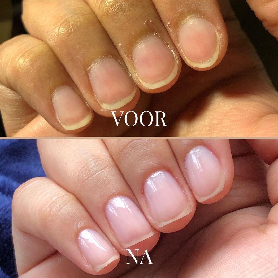 GentleGrip Elektrischer Nagelschneider