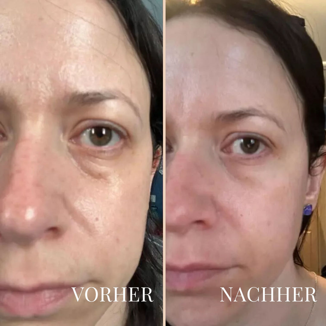 LinaLift Hals- und Augenpflege Creme