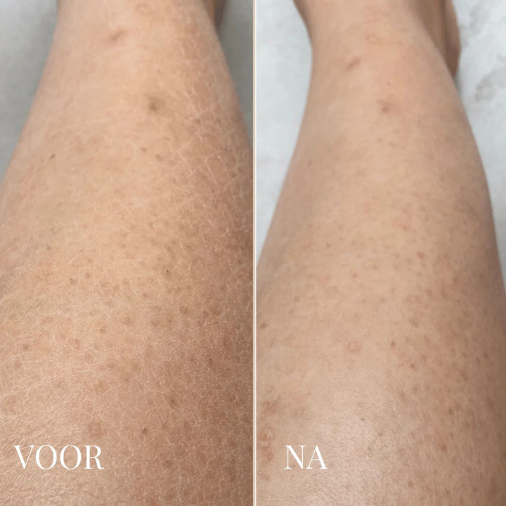 DR. MELAXIN KÖRPERPEELING SPRAY