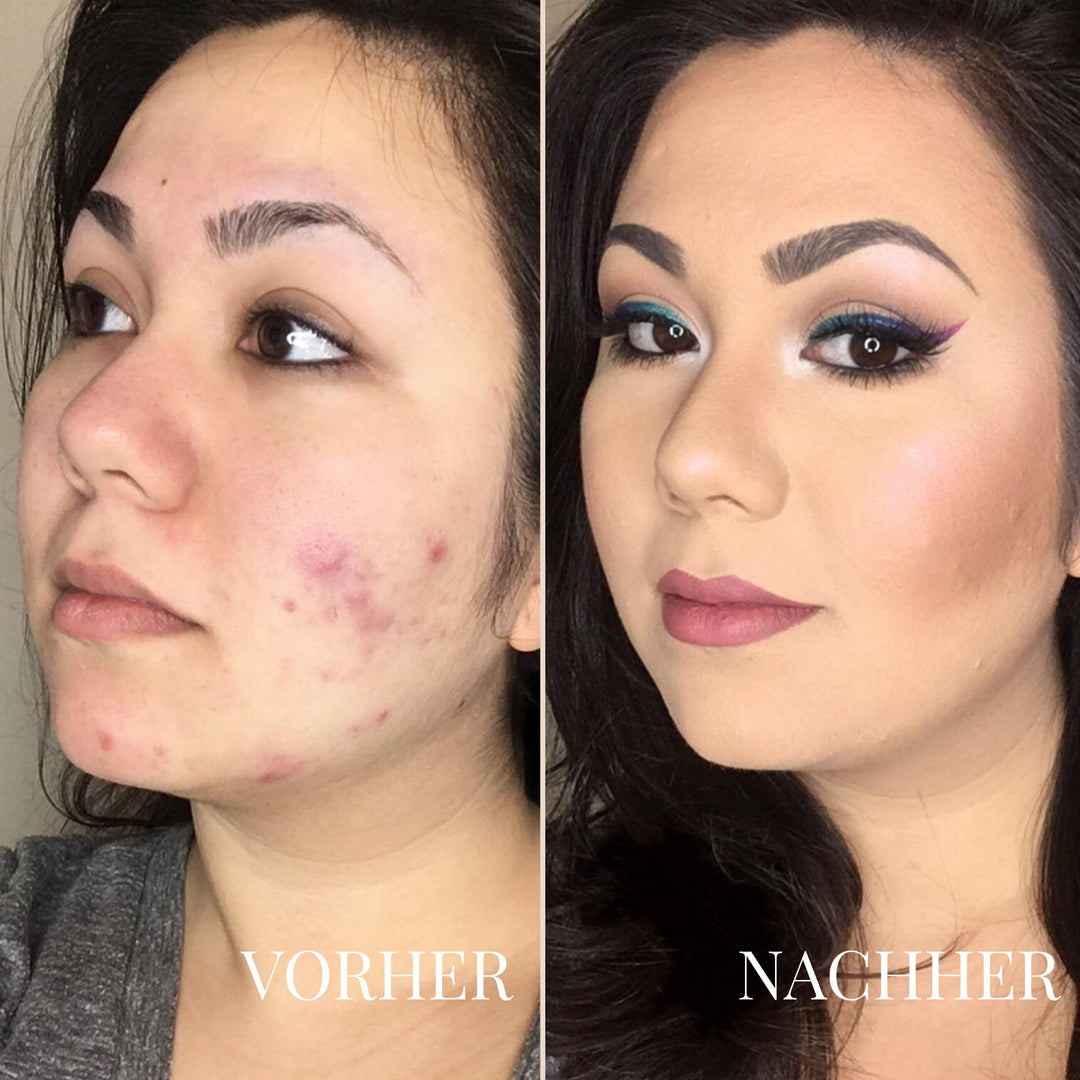3-in-1 Perfektions-Concealer