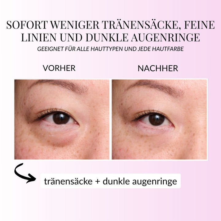 InstantEye Aufwachcreme