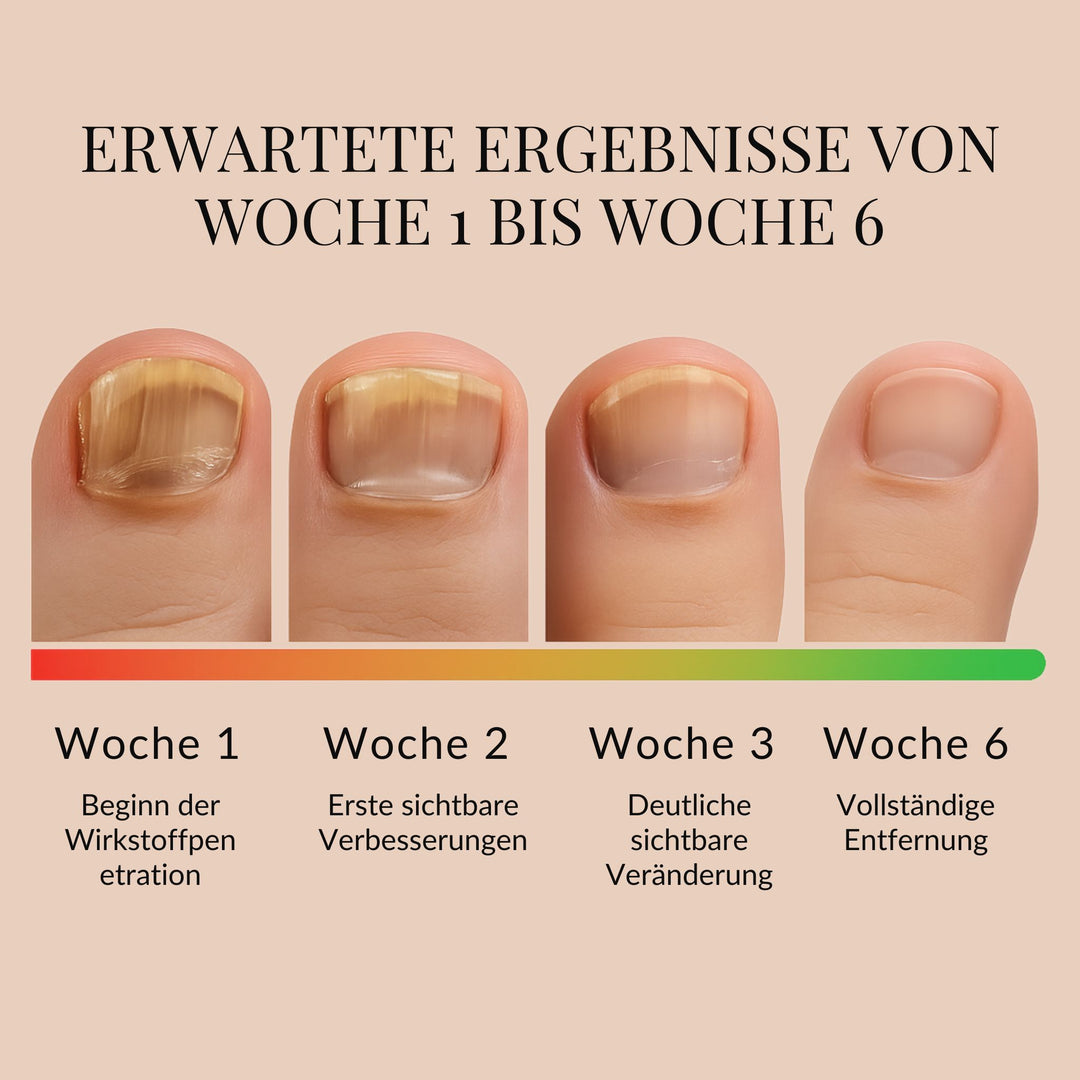 ReviveNail Patches | For Nail Fungus and Nail Calcium