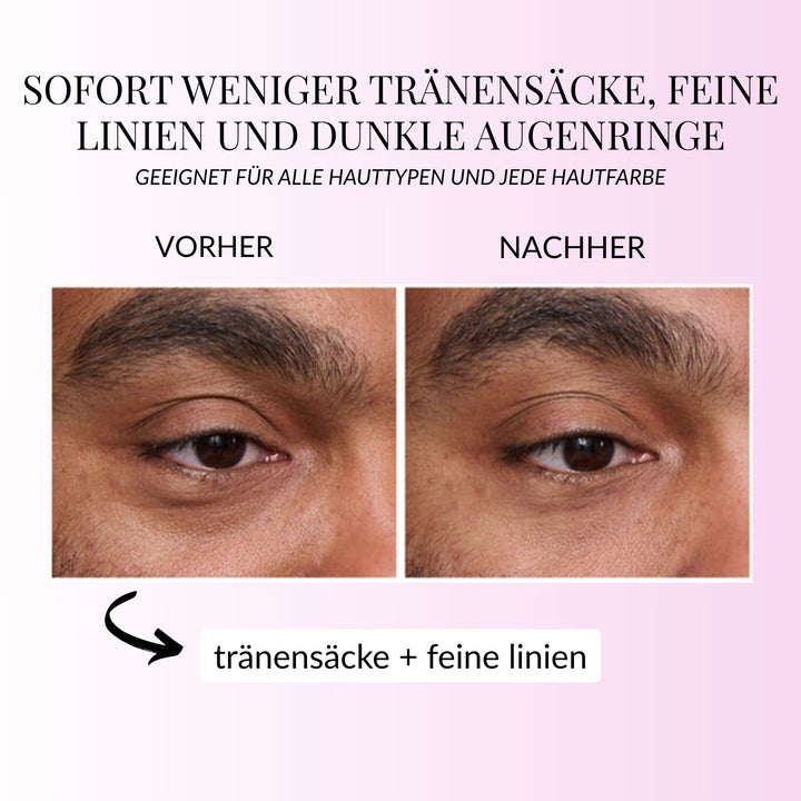 InstantEye Aufwachcreme