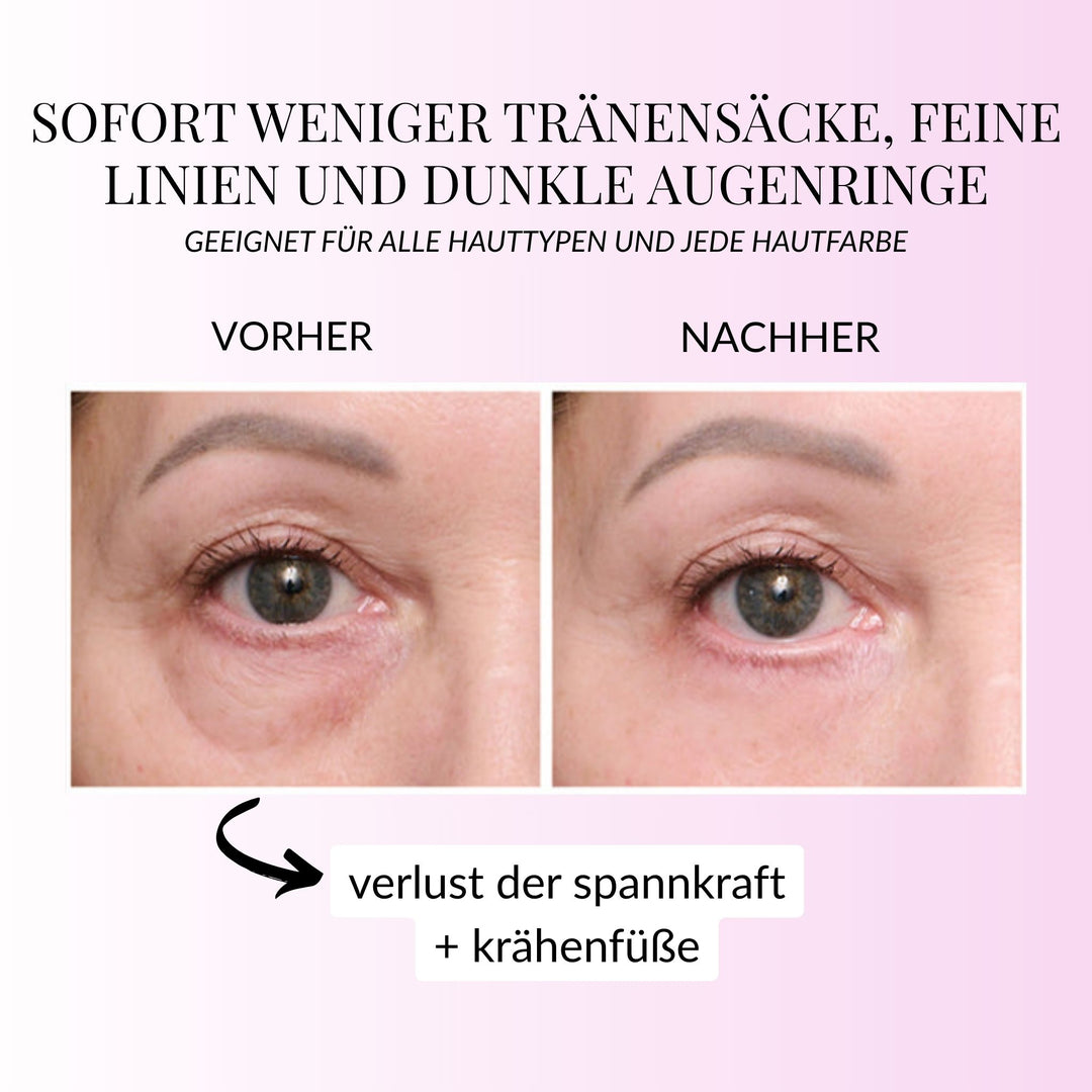 InstantEye Aufwachcreme