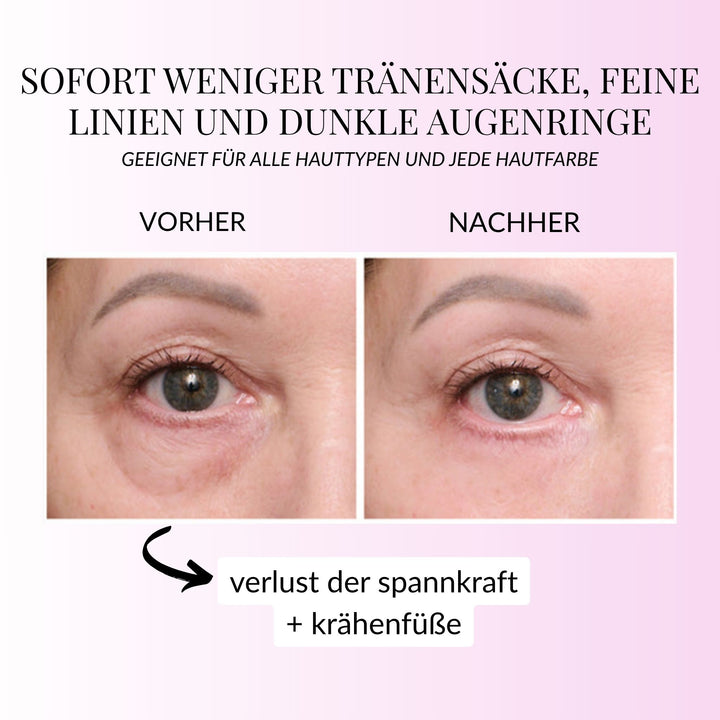 InstantEye Aufwachcreme