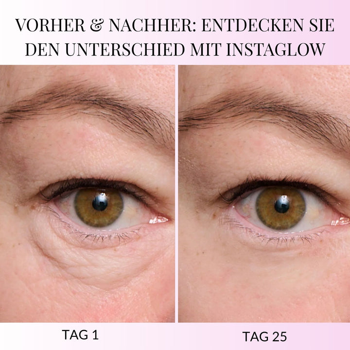 InstantEye Aufwachcreme