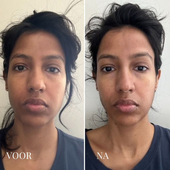 De-Puff Daily Eiskalter Gesichtsroller