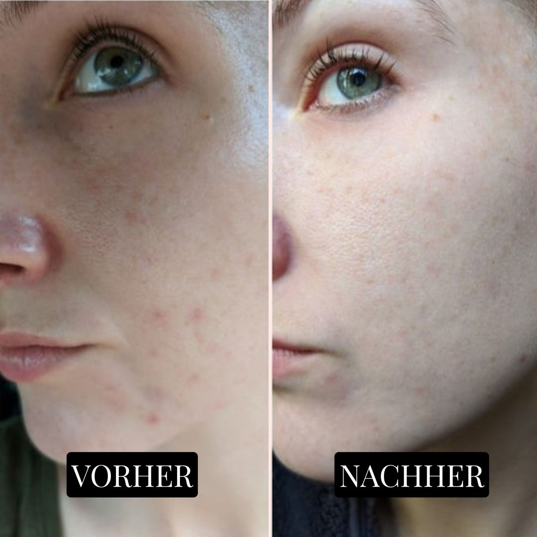 GlowNest Collageenmasker