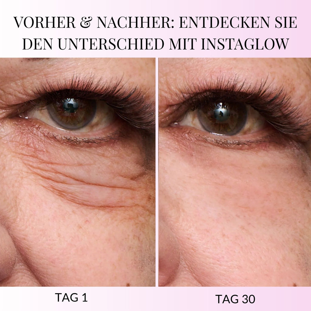 InstantEye Aufwachcreme