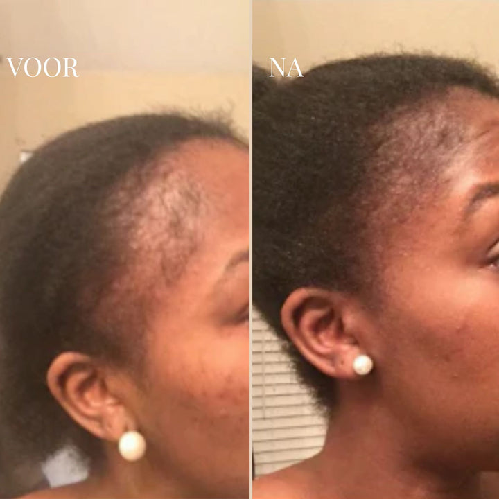 CURLVIBE | BRING DEIN HAAR WIEDER ZUM LEBEN