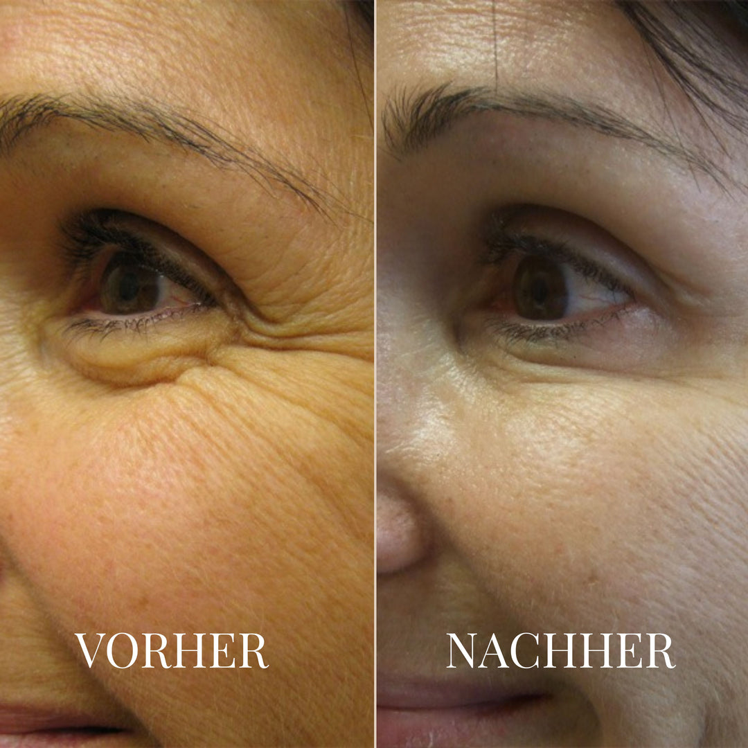 BALANCEBLOOM ANTI-AGING BALM