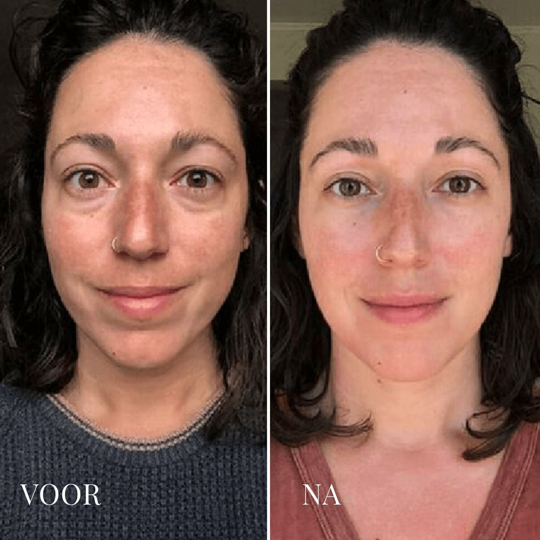 De-Puff Daily Eiskalter Gesichtsroller