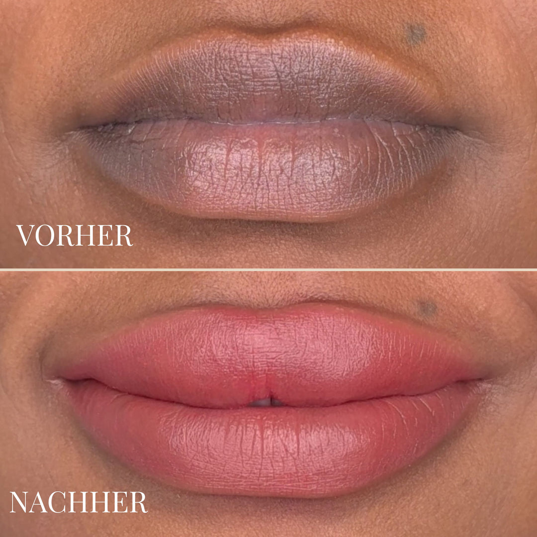 LEMON LIP BALM | DUNKLE LIPPEN NATÜRLICH AUFHELLEN