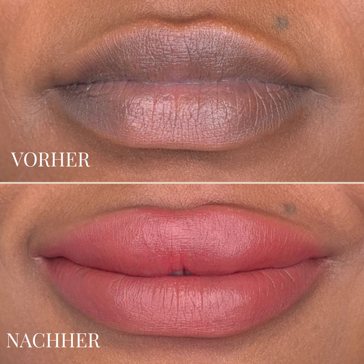 LEMON LIP BALM | DUNKLE LIPPEN NATÜRLICH AUFHELLEN
