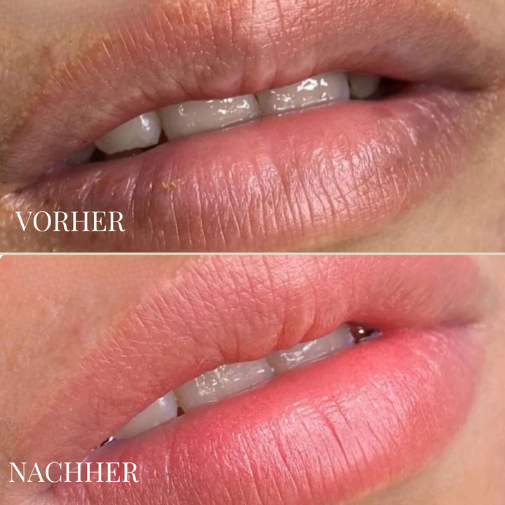 LEMON LIP BALM | DUNKLE LIPPEN NATÜRLICH AUFHELLEN