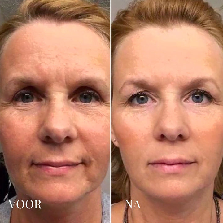 De-Puff Daily Eiskalter Gesichtsroller