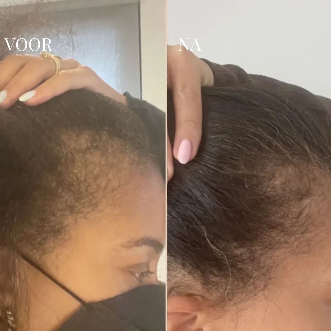 CURLVIBE | BRING DEIN HAAR WIEDER ZUM LEBEN