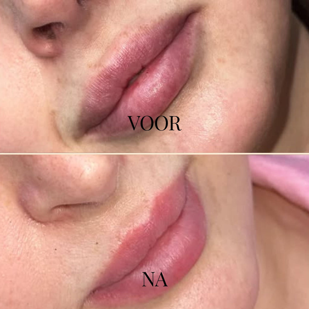 DewKiss Lippenbalsam