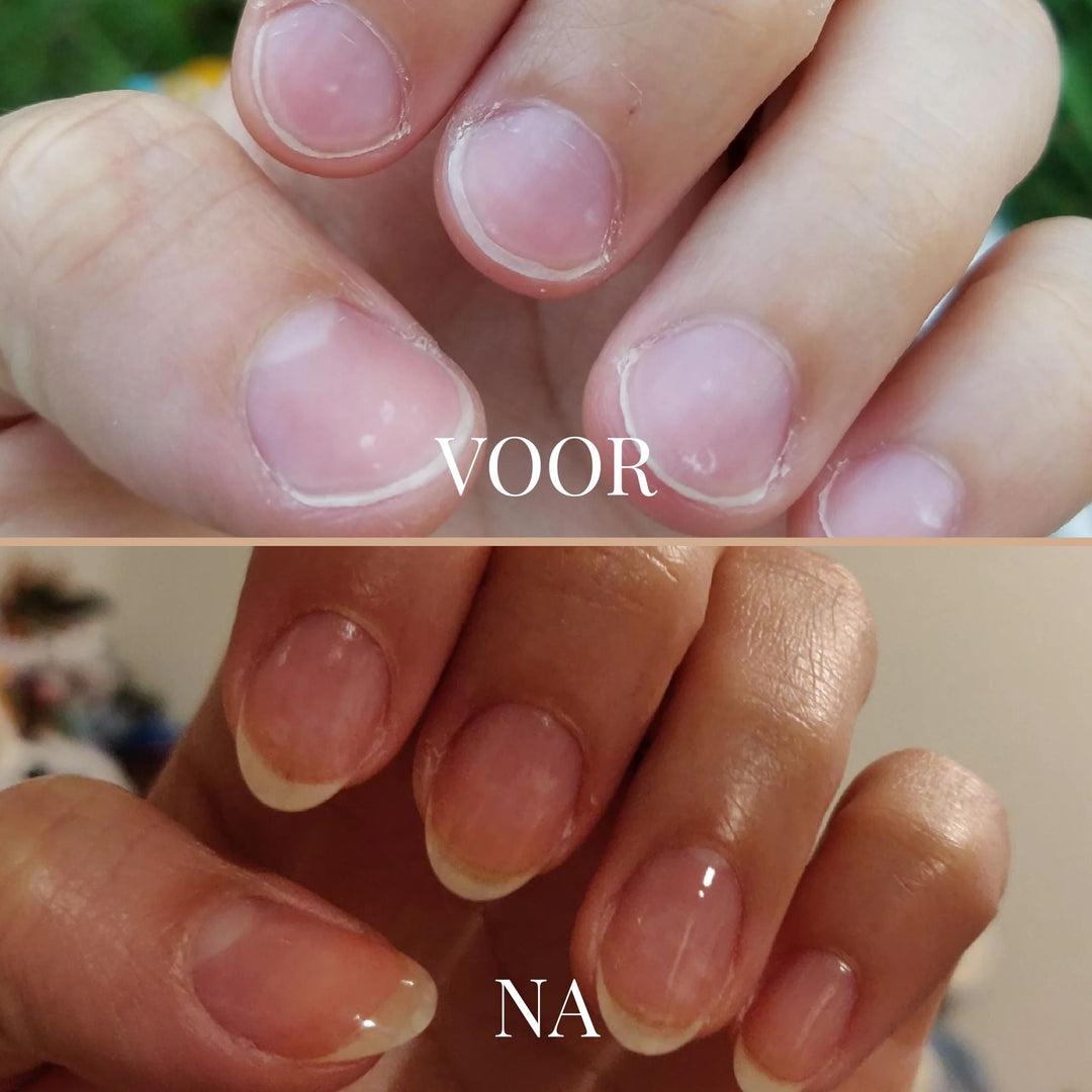 GentleGrip Elektrischer Nagelschneider