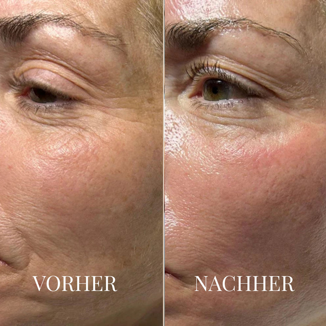 BALANCEBLOOM ANTI-AGING BALM