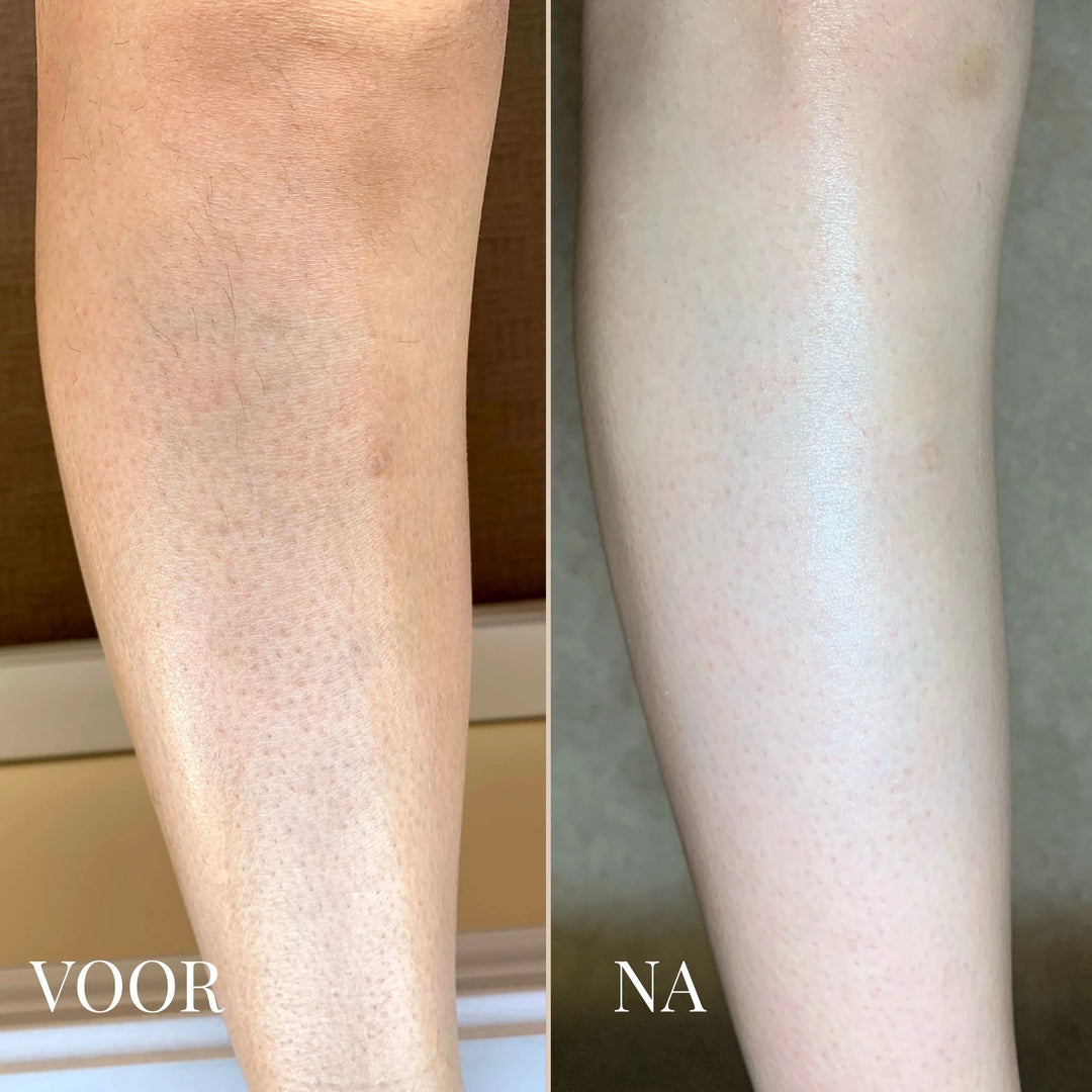 DR. MELAXIN KÖRPERPEELING SPRAY