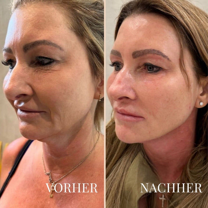 LinaLift Hals- und Augenpflege Creme