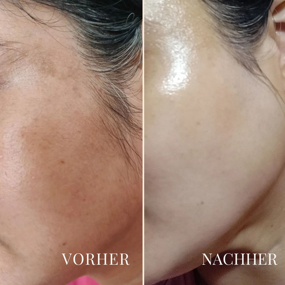 PeachAway Gesichtshaarentferner