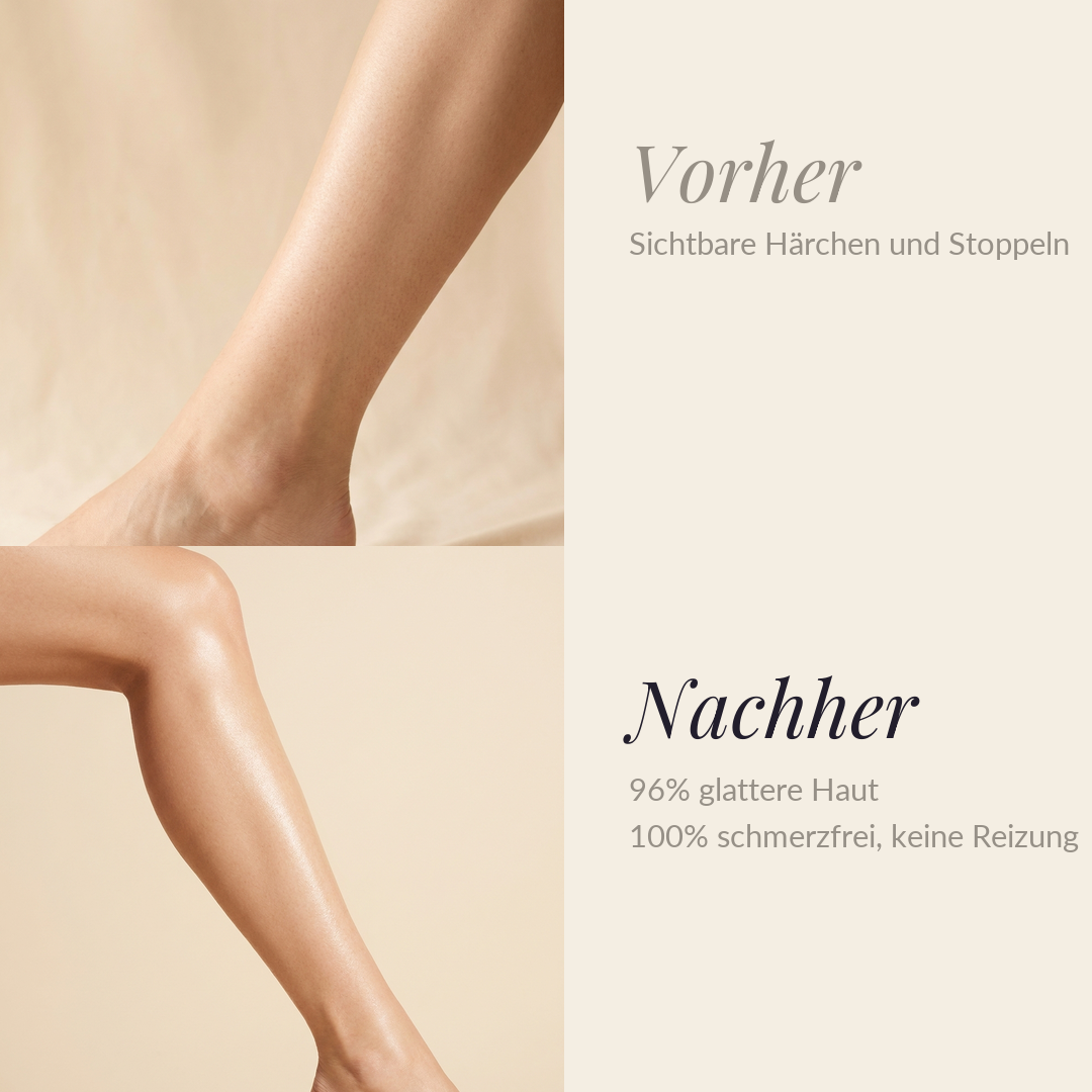 Vorher/Nachher: 96% glattere Haut, 100% schmerzfrei
