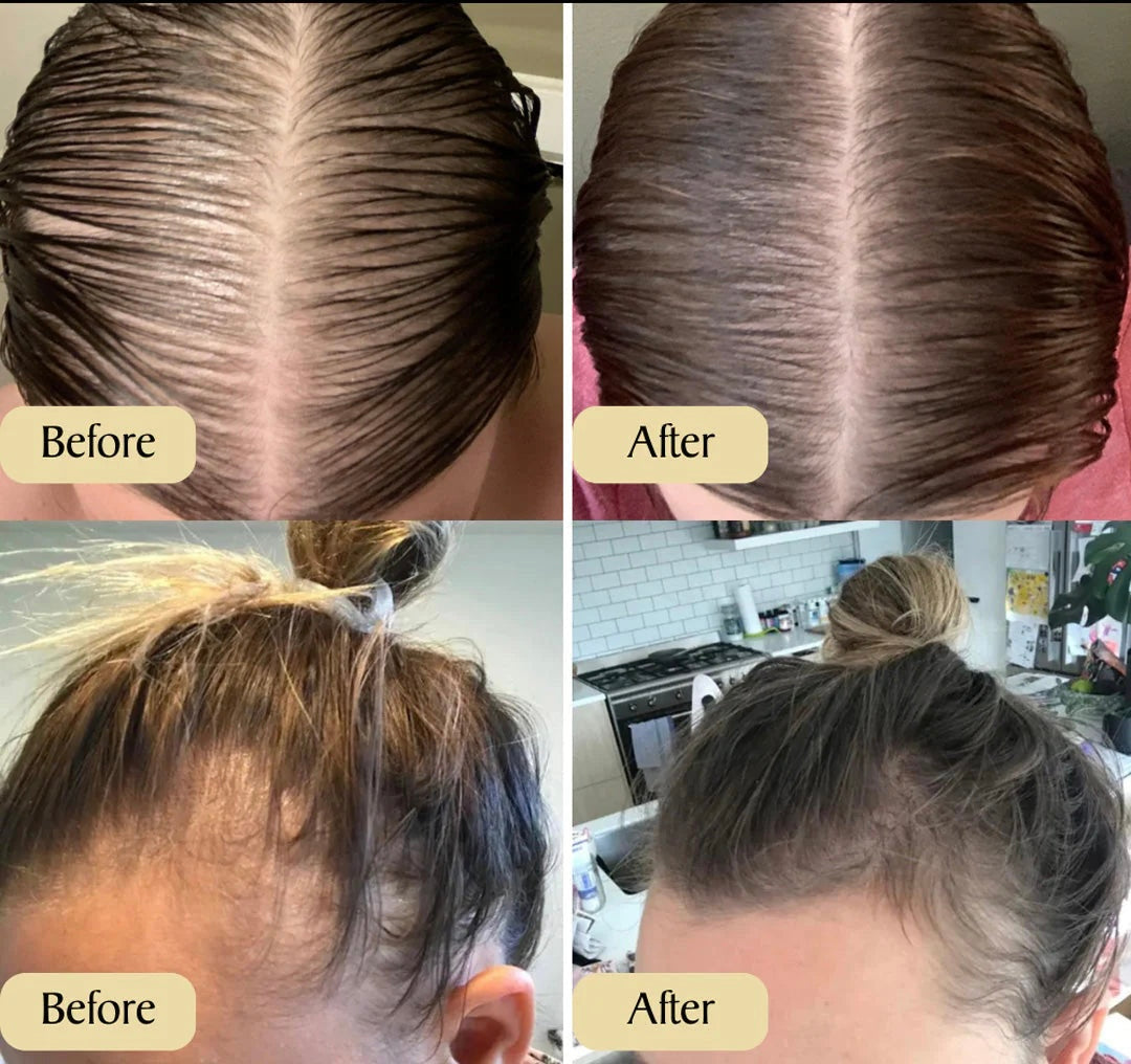 GROWTHE HAARWACHSTUM SERUM